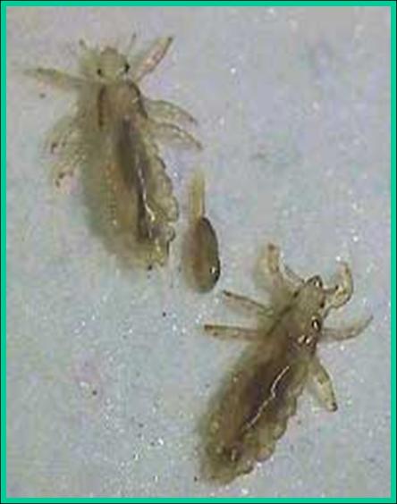 Life Cycle of the Head Lice  Nit Wits  Lice Removal  Louisville KY